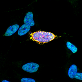 Our work related with amyotrophic lateral sclerosis linked FUS and U7 snRNA