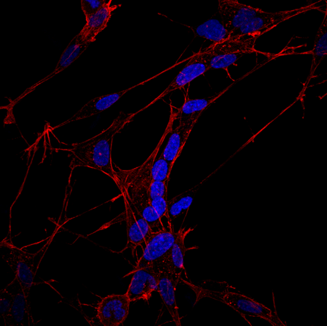 Actin staining of differentiated SH-SY5Y cells